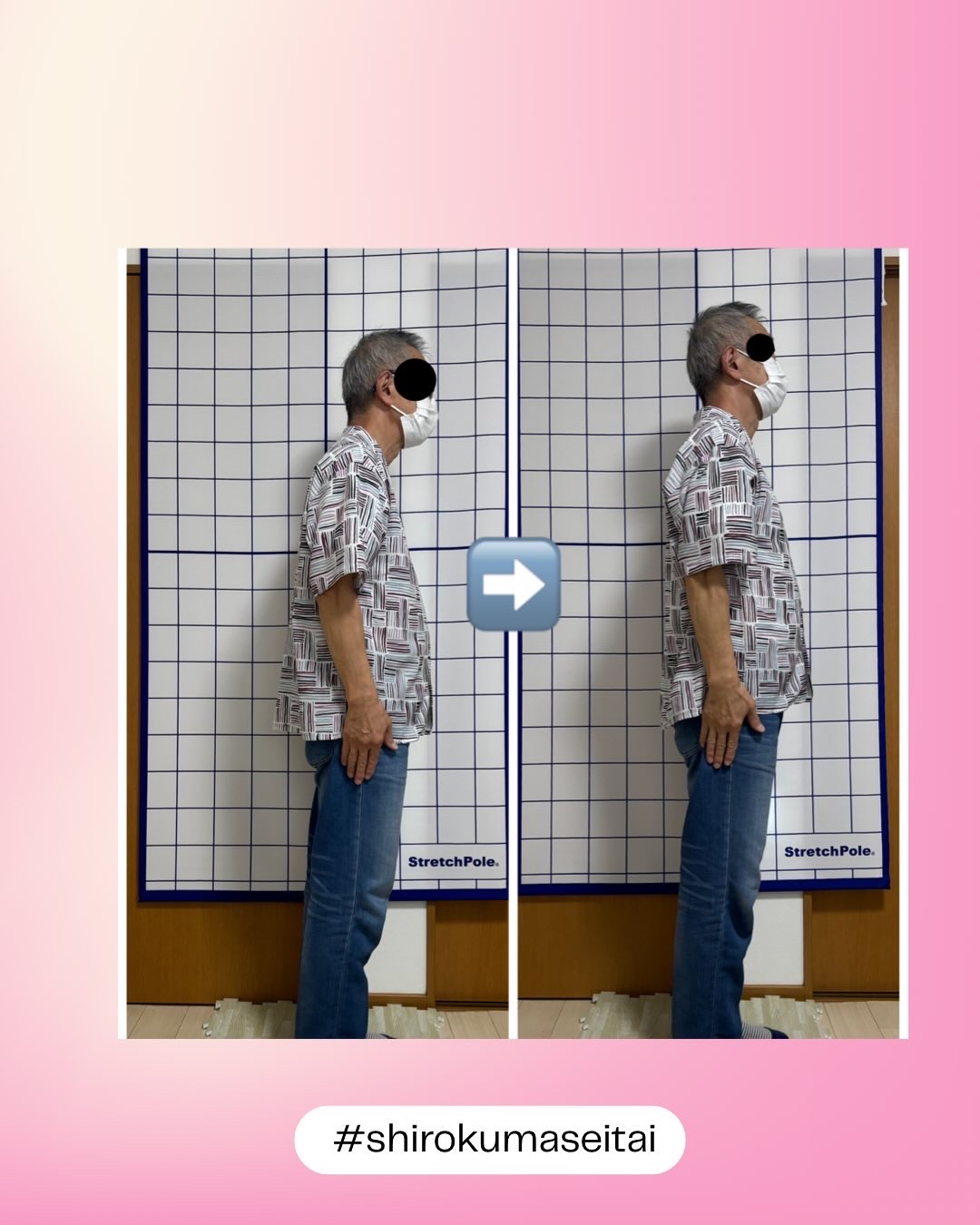 座骨神経痛・すべり症のお客様